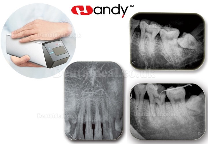 Handy HDS-500 Intraoral PSP Scanner Dental Phosphor Plate Scanner